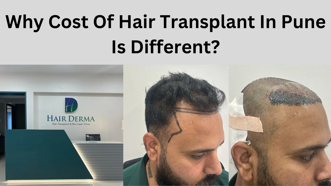 Hair Transplant Cost in Pune